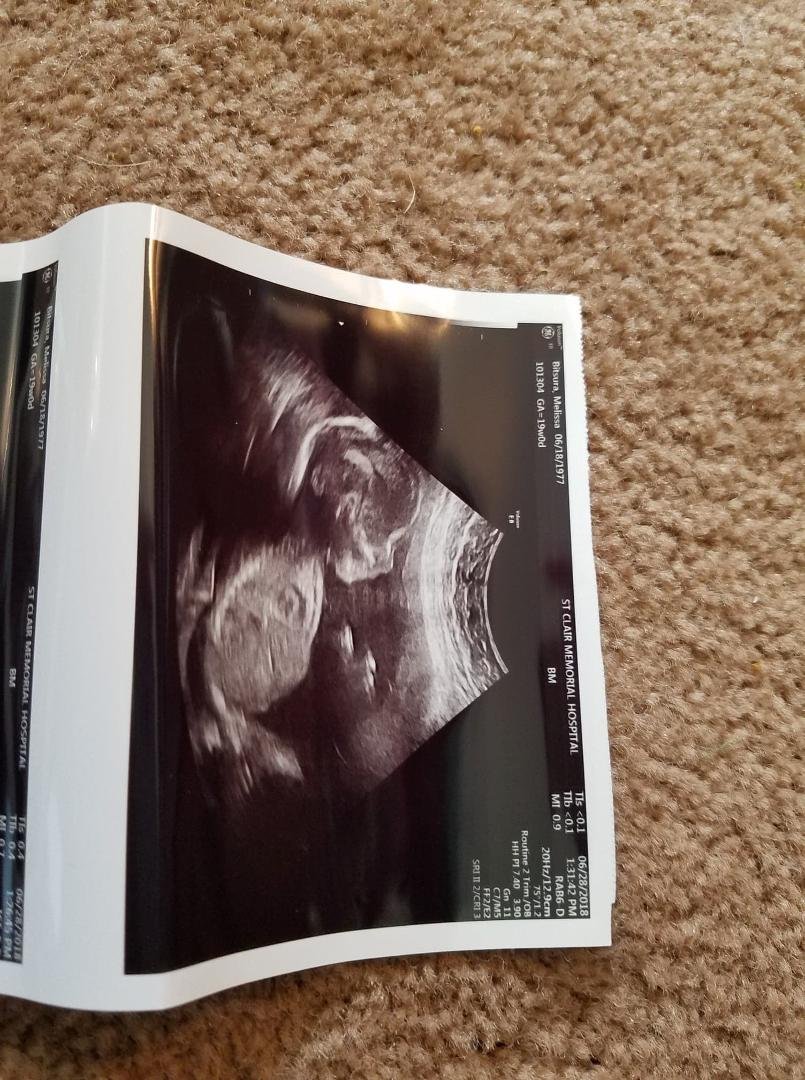 Our new granddaughter...due in October 2018!! Blessing!! <3
