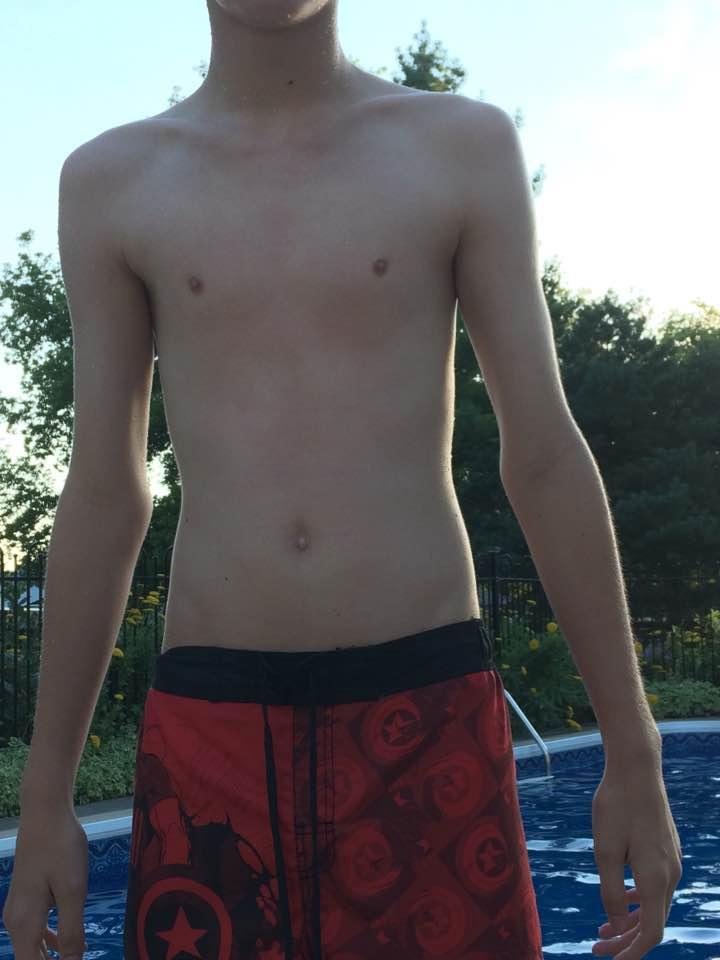 My attempt at diving didn't work well in our pool #Divingfail