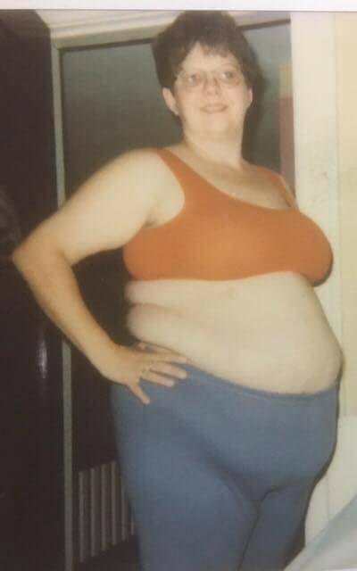 I was married to my 1st husband. This was taken about 1994. It was b4 my gastric bypass & I weighed at least 300lbs if not more.