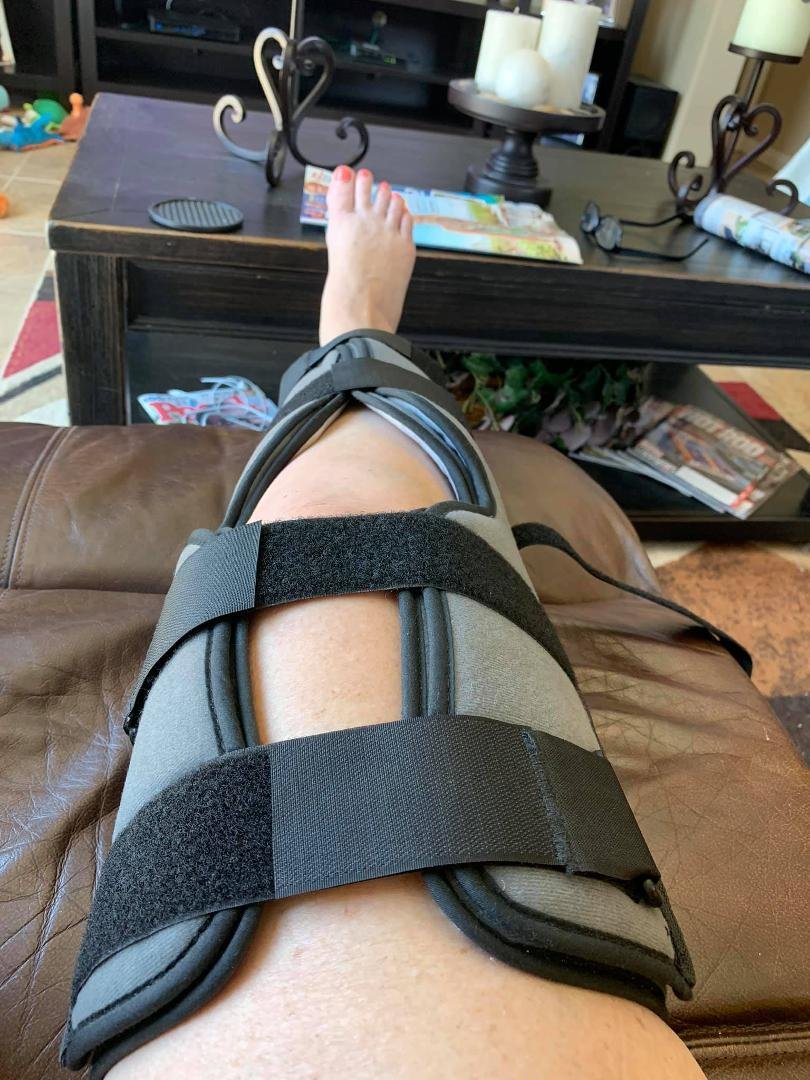 Took a fall, tripped over the dog. I need to look out and be more careful. I know it!!! Life’s a bitch sometimes. At least it isn’t broken. 🙏🏻👵🏻😘