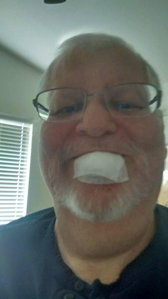 Me after having a growth removed from my lower lip this morning.  No, Julie didn't punch me even though I may have deserved it.  Better this than jeans falling down around your ankles, huh?