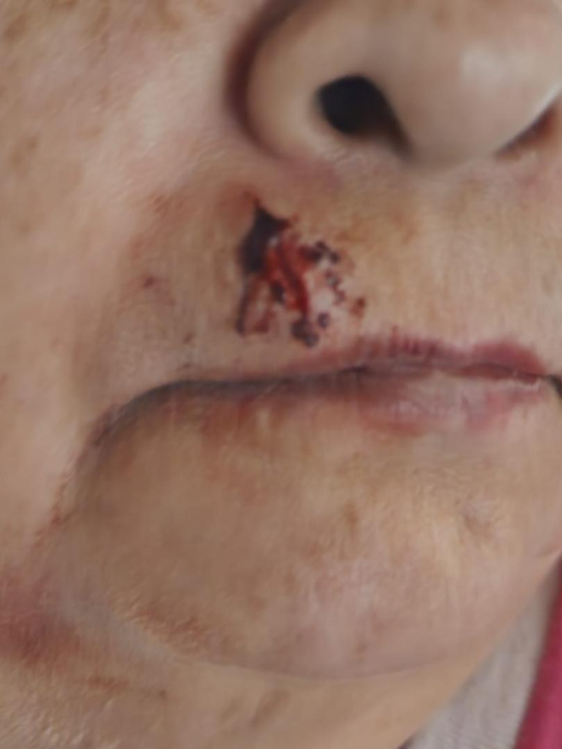 Yup, another close up of the lip.