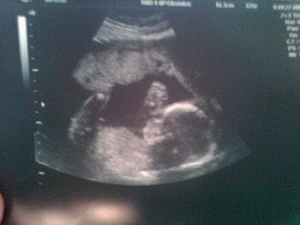My grandson. Due August 5th.
