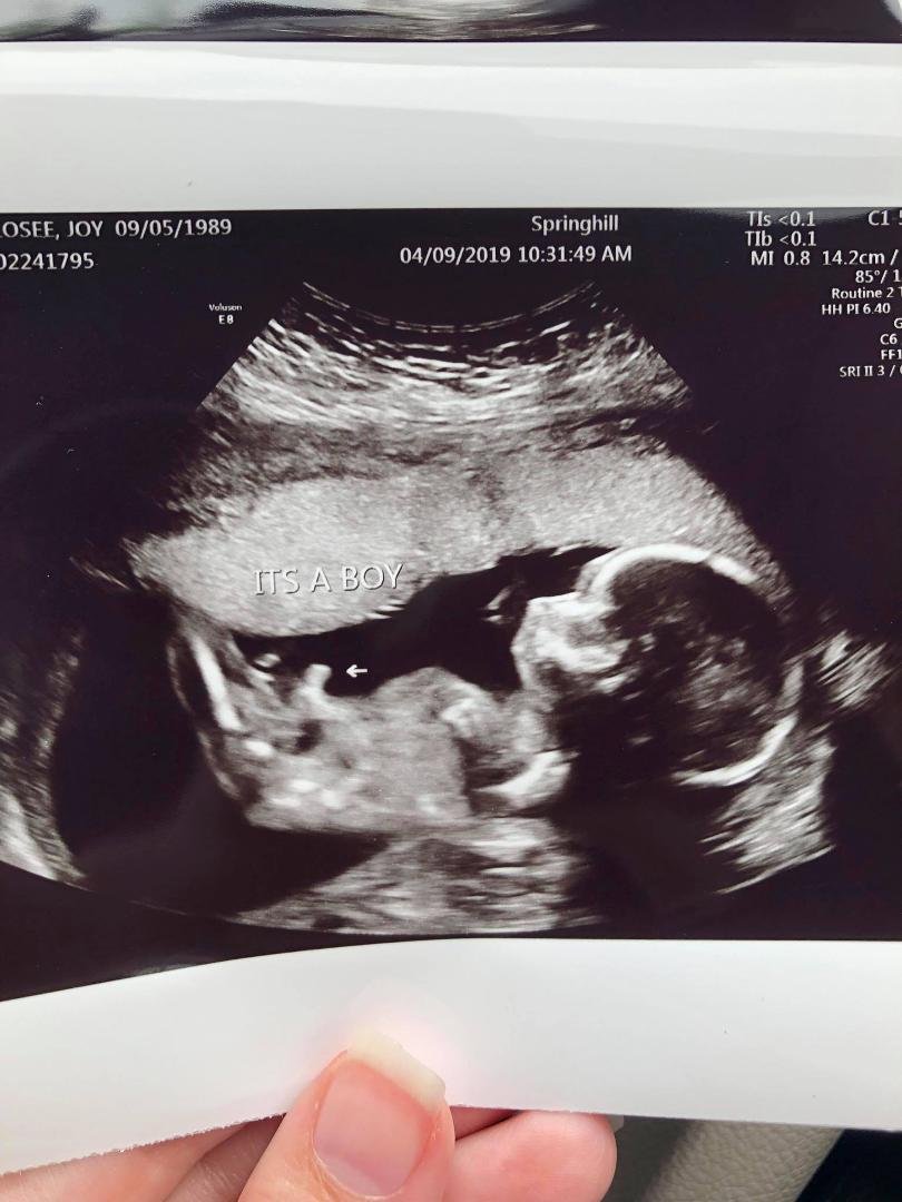I have a grandson on the way