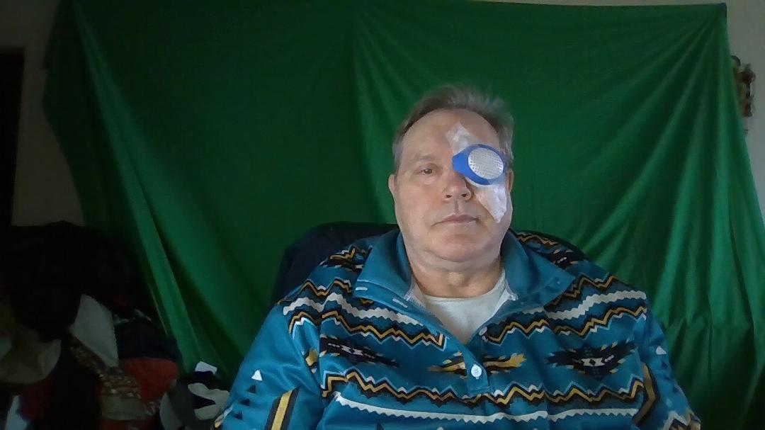Here I am post surgery. You can't see my eye yet because it's covered by this shield. Will send another pic tomorrow afterI get the shield off.