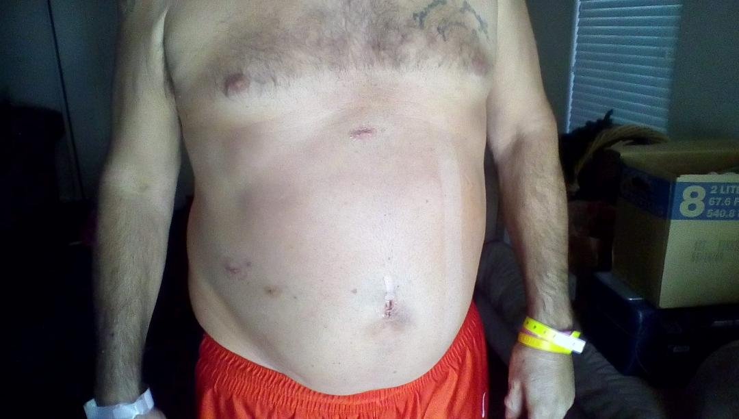 battle scars
