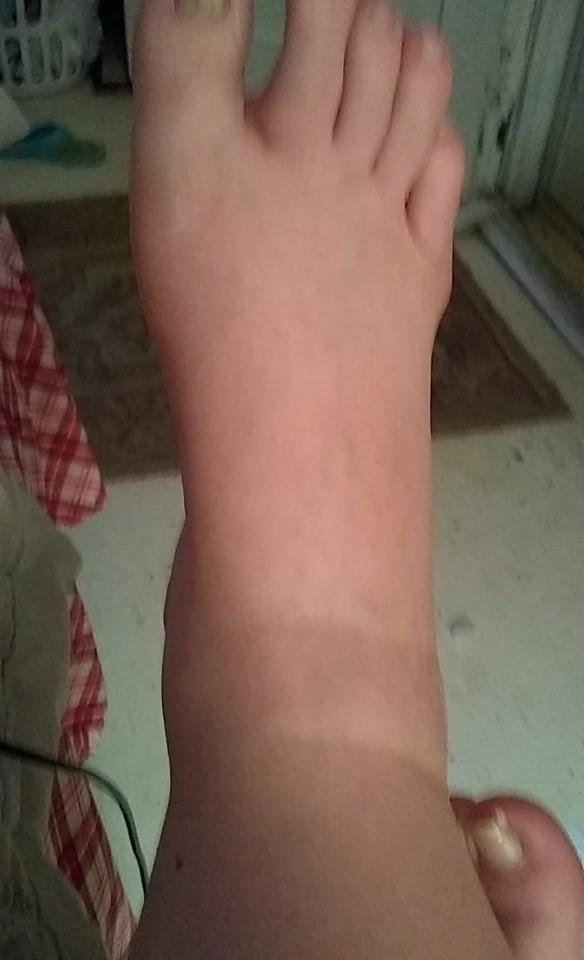 Right foot, ankle and calf are swollen again. This is becoming a weekly thing. Hubby says I need to go to the doctor about it. Meanwhile, he is making me stay off it.