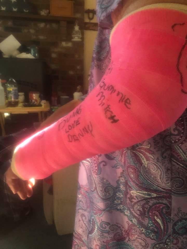 Four weeks ago was in a soft cast and now I am in hard cast for the next four weeks and broke my wrist if two different spots and I have to stay with Danny and Michelle for the time being