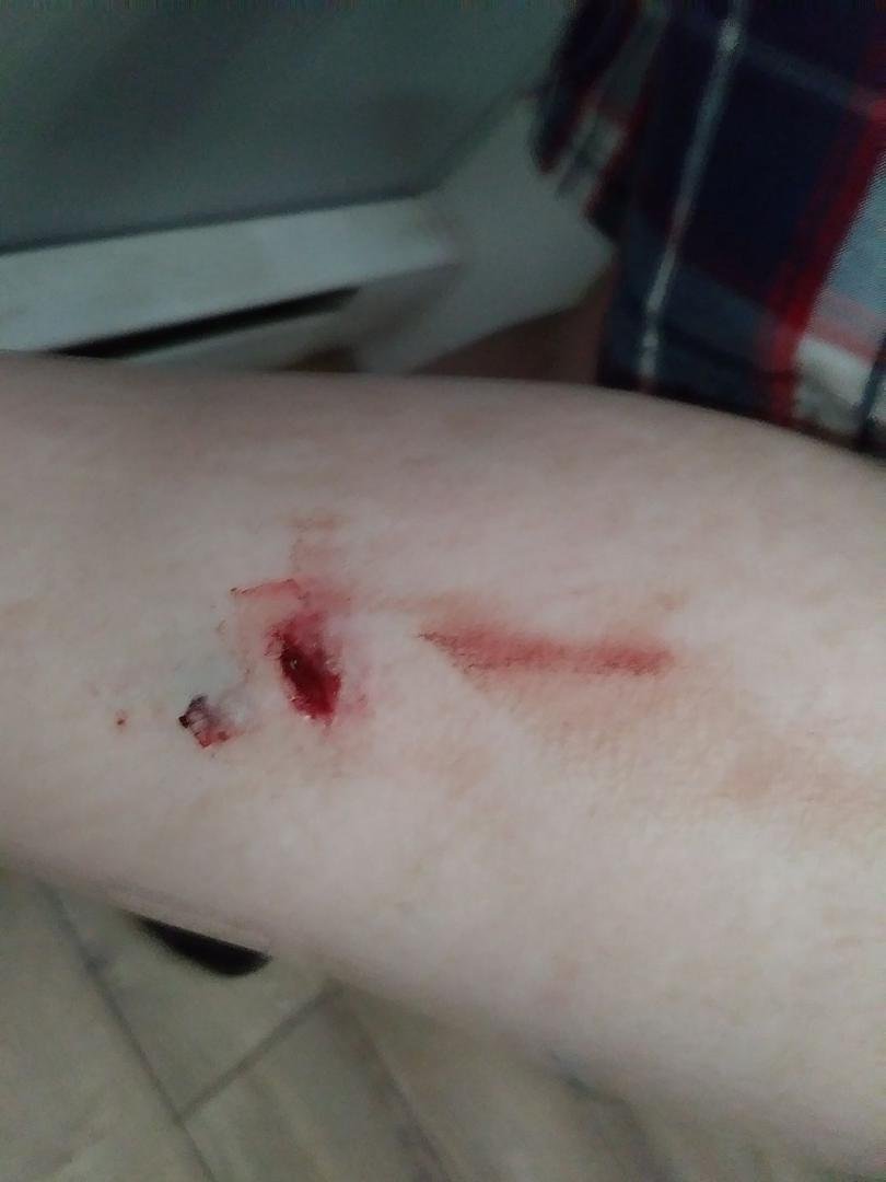 Criss de criss il y a personne qui attache leur chien et voilà je me fais morde en protégeant mon petit chien.