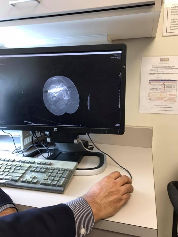 CT scans