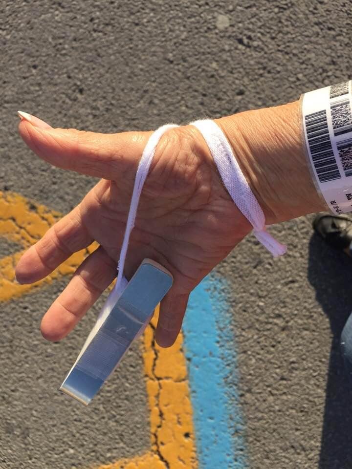 Manchester Unity Medical finger split wrap job