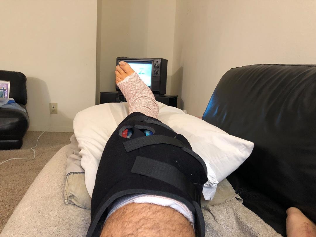 Knee surgery seems to have gone well. A little sore, but able to bear weight on it with or without crutches. I’ll have a better idea where we are after the next couple of days, but so far, so good.