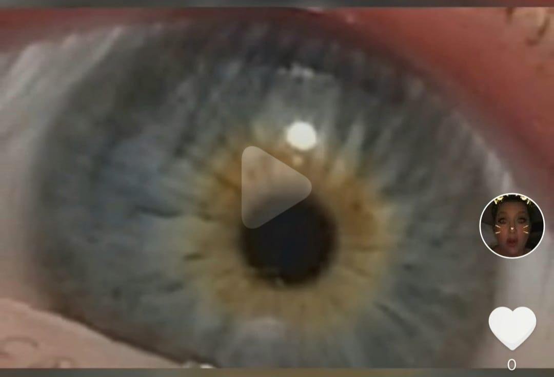Here is a snippet from a video..when I cry my eyes turn bright green..my mom had gold eyes and my dad has green..but my grandma did have blue and one of my sons has blue eyes..ok I know I have gold around the pupil..but is