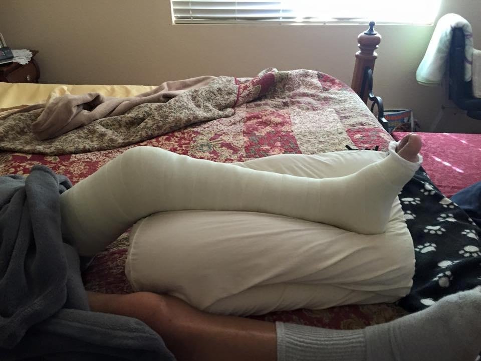 So this happened to my husband yesterday. Fractured tibia. Long leg cast. This man does nothing easily!!