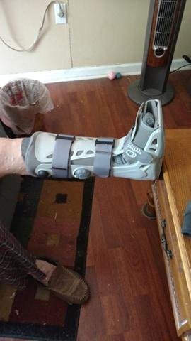 My new "boot" the Ortho Doc said I had a "broke foot"
Dr Howard - a small bone in ankle (same thing) anyhow
Both said no surgery ( No pain meds either) take off 1 -2 times a day flex little it definitely gives supp