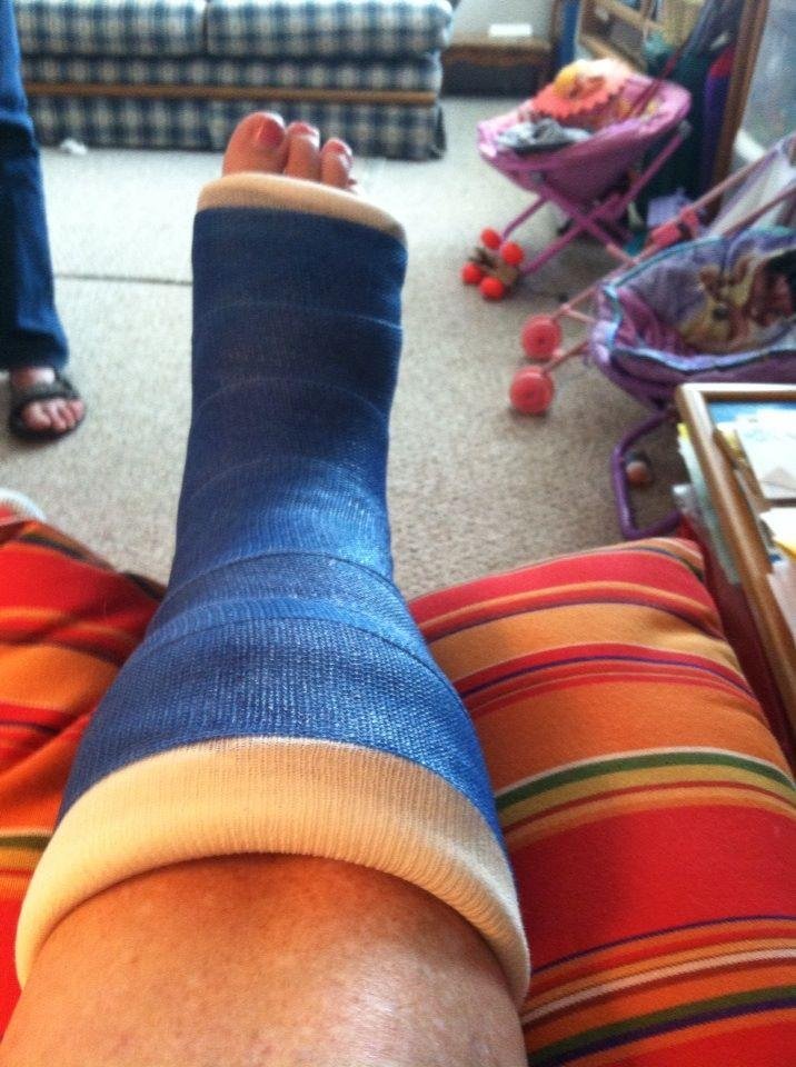 Broken foot did it last week in Big Bear