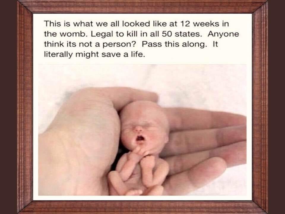 Greg Gracz's album, Timeline photos