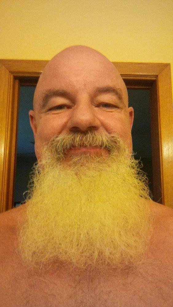 Santa beard becomes Santa goatee so cancer spot can be worked on by the doctor.
