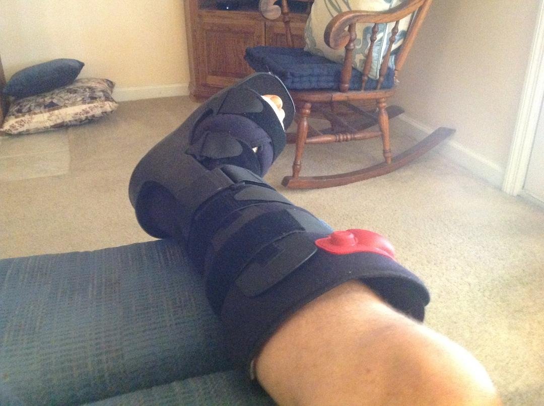 Left knee replaced now right foot reconstructive surgery. Four more surgery and I'll be back to normal.