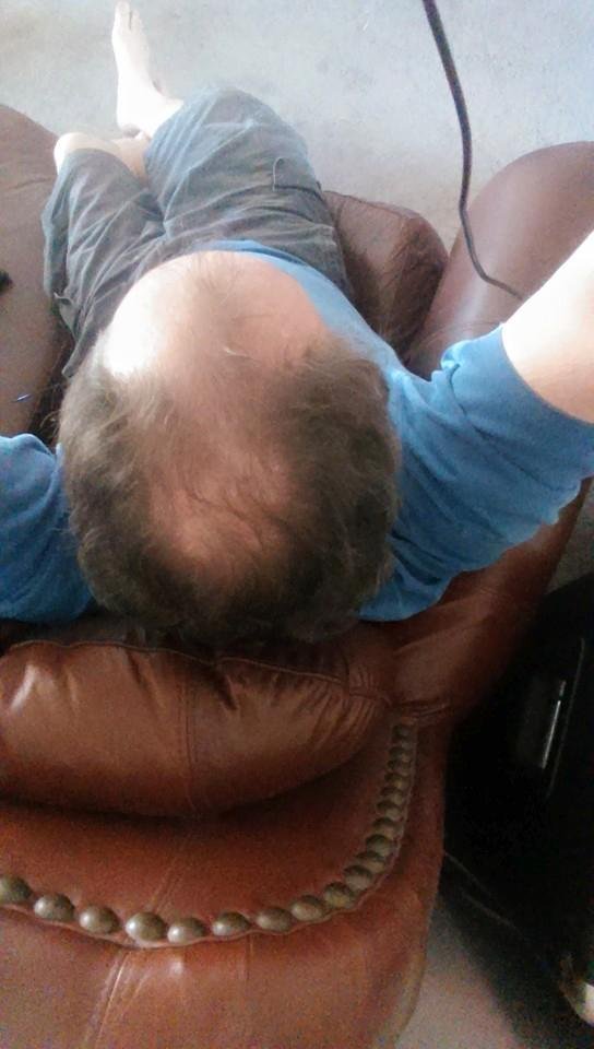They say when you go bald in the front it means you're a great thinker.
When you go bald in the back it means you're a great lover. When the 2 grow together you think youre a great lover! We all know where I stand