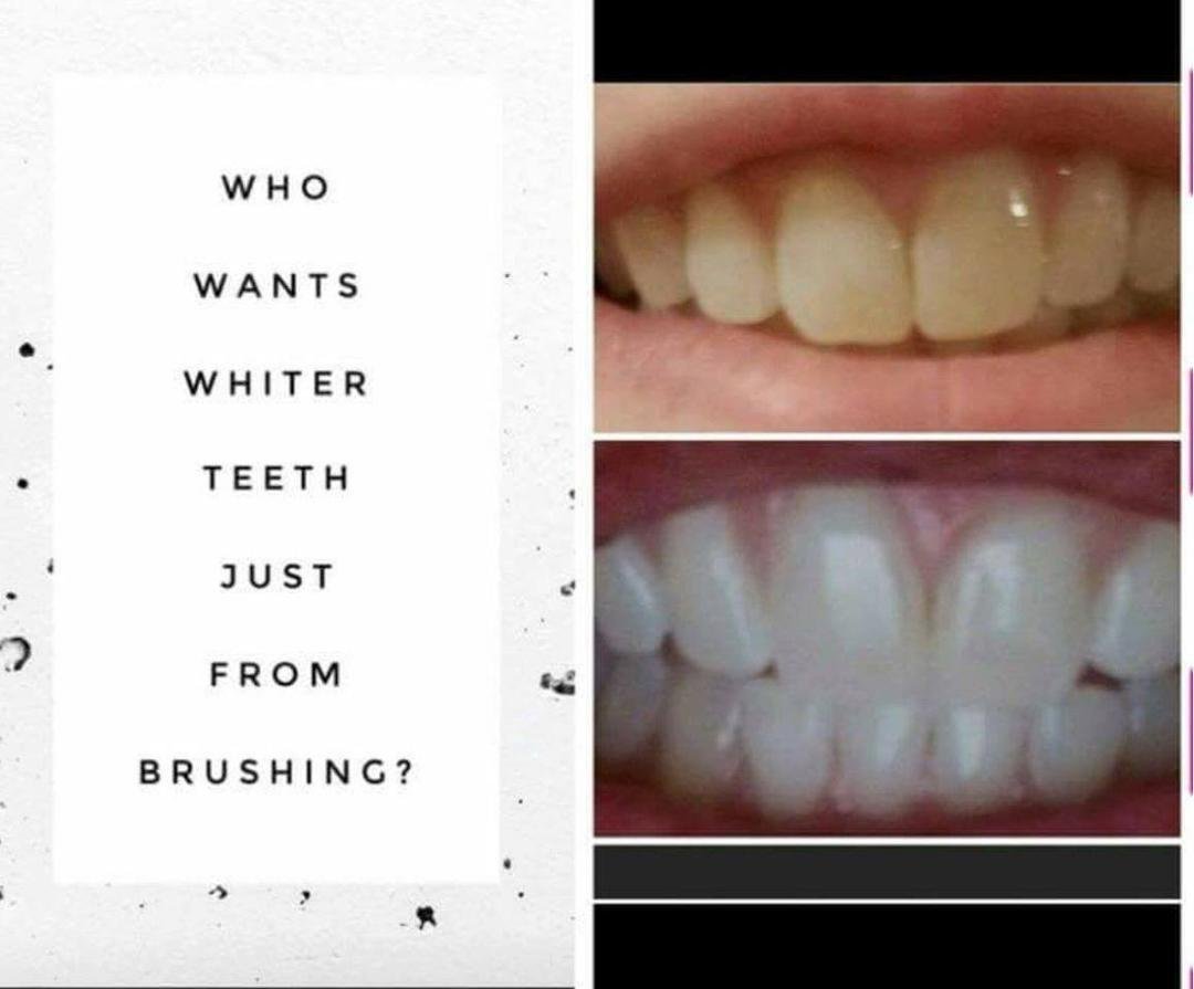 Hey friends! Who wants whiter teeth just from brushing? I have seen so many amazing results that I decided to sell this toothpaste! I'm taking orders! One tube lasts 6-8 weeks! Comment below or Msg me!
❌ no bleach / no pe