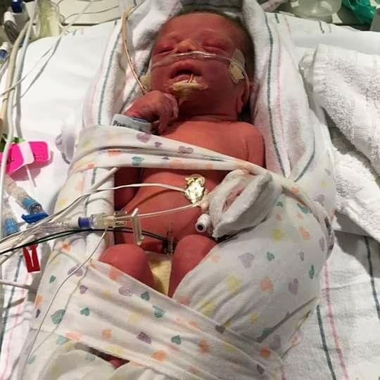 My daughters very good friends baby
. 4lbs... Love you and see you soon..xoxo