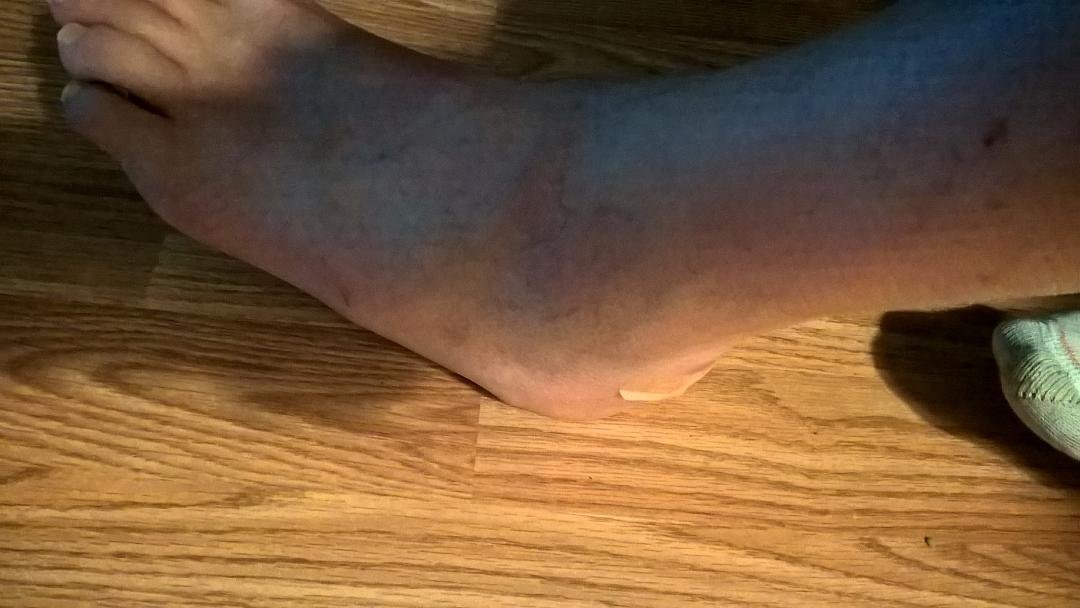 Thought I broke it but I didn't bad sprain. Doctor in ER asked if I ever broken it. I said no. He asked what I did to it. I said I played hard on it for years. Basketball 🏀,some football 🏈 and a lot of softball!!!! Said h
