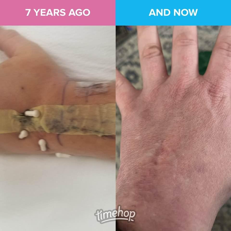 Ouch