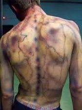Tyler Bailey, this is the pic I was talking about