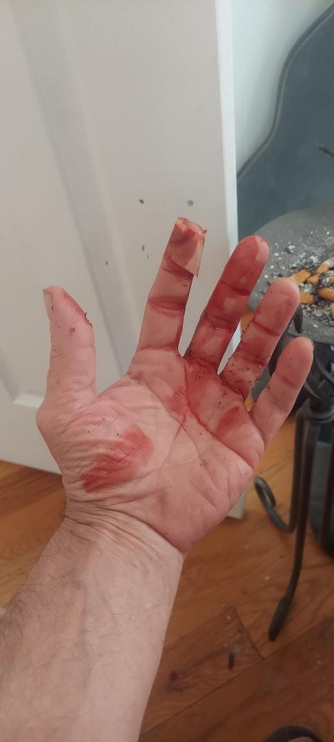 Be careful when you're washing your dishes especially if you just bought a new sharp knife