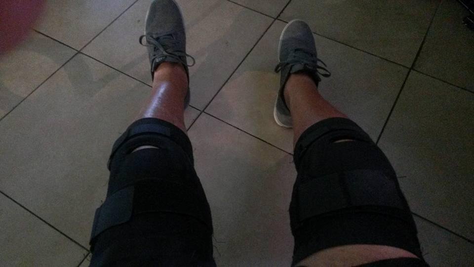 This is what your knees look like when you get older you wear braces