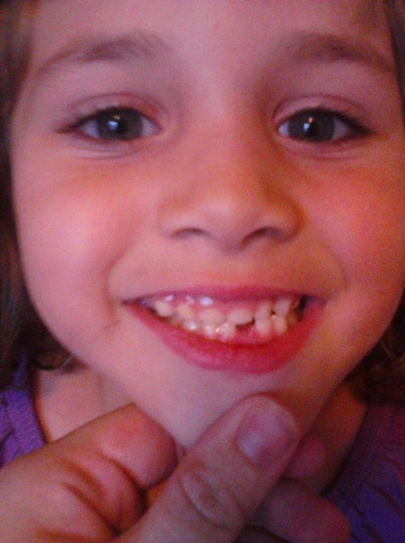 Natalie's first lost tooth!!