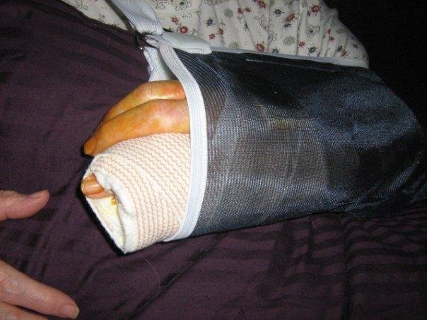 MY HAND LEAVING THE HOSPITAL