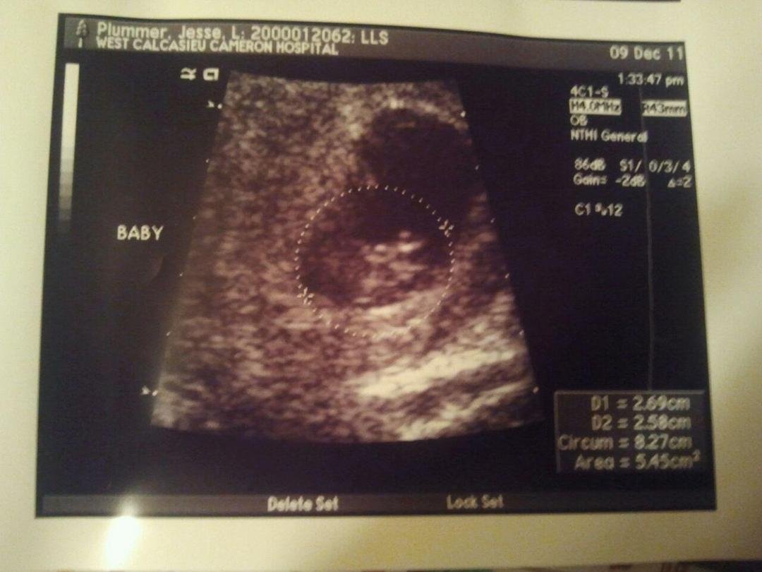 Our baby -9 weeks