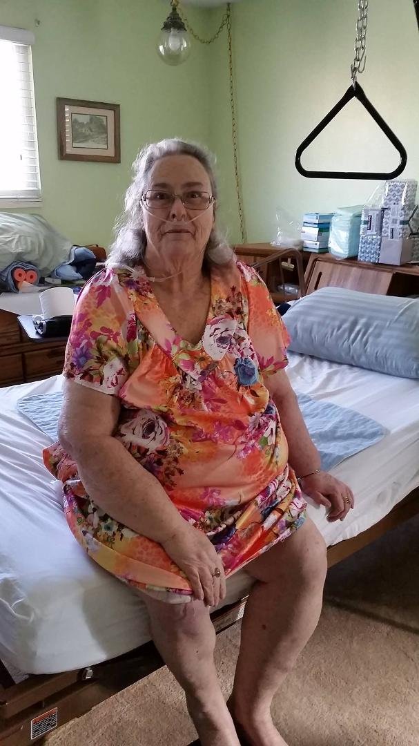 I thought it is time to give an update on Betsy again. Today she was visited by her Doctor. The Doctor is pleased with the progress Betsy has made. When she was discharged from Hospice all she did was lay in bed, now she