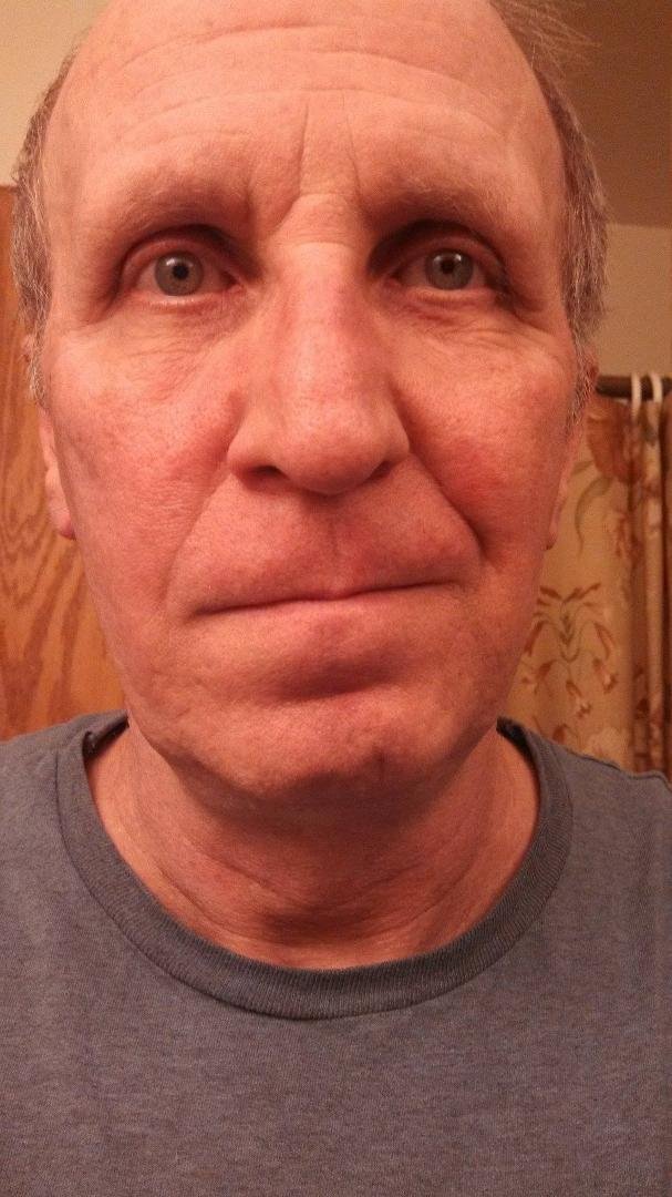 Took off all the hair from my face