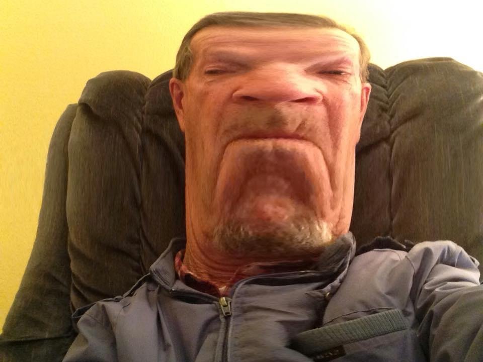 Plastic surgery did not go well !!