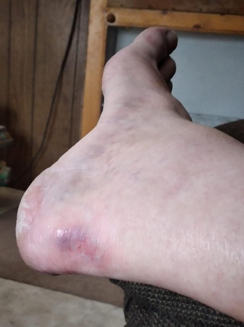 Damn that hurt shut the front door on the back of my heel
