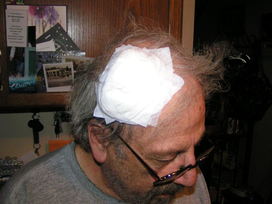I just joined the "Hole in the Head Gang"