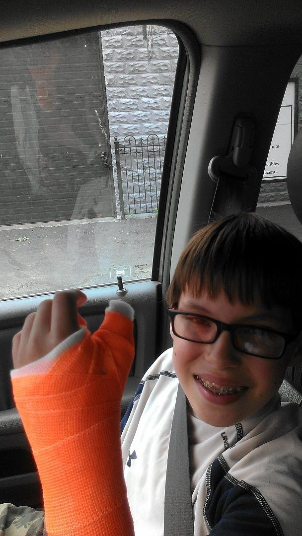 This is why you should wear safety gear when doing extreme some wrestling