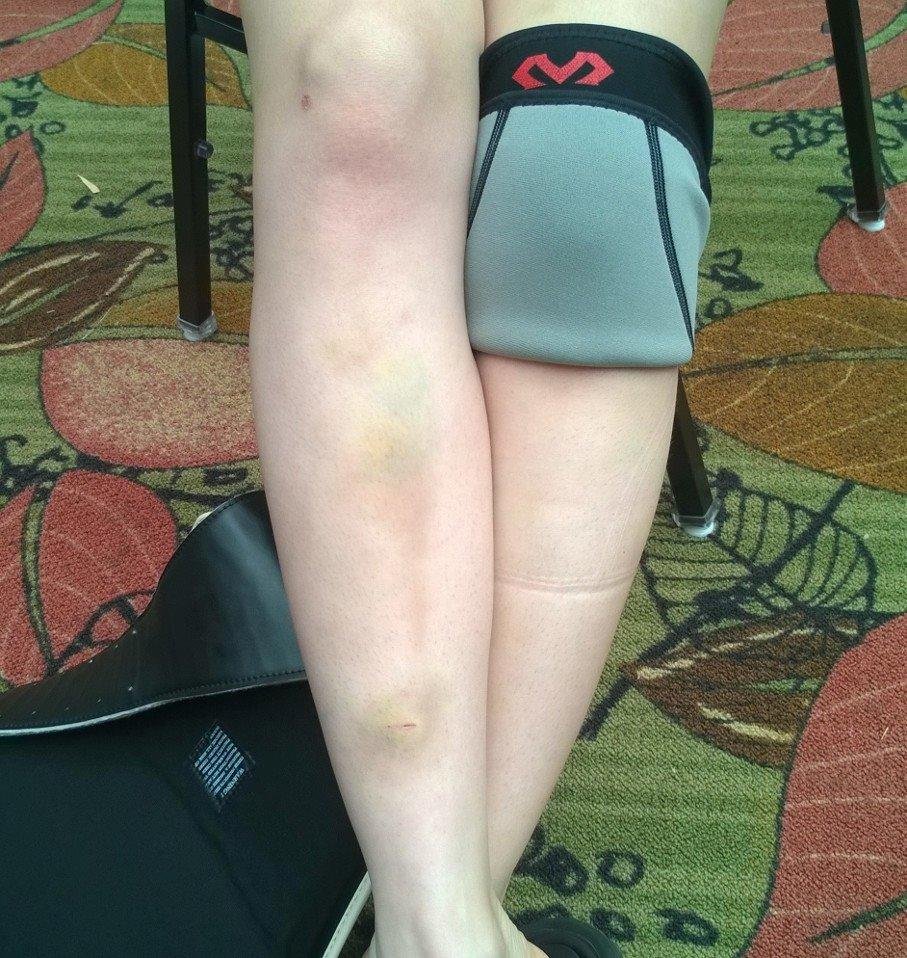 ...with shin guards.