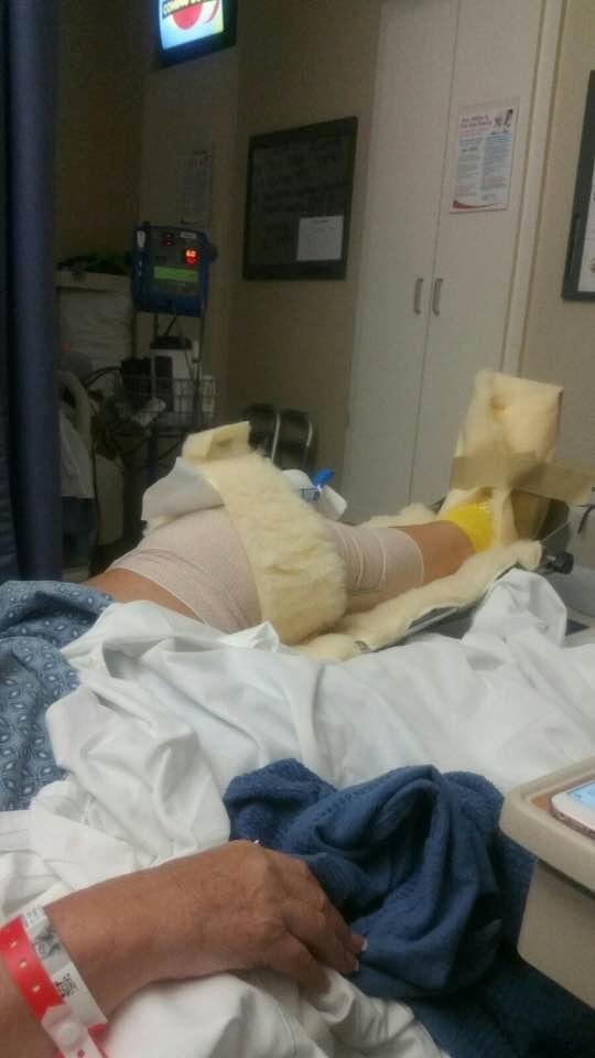My knee