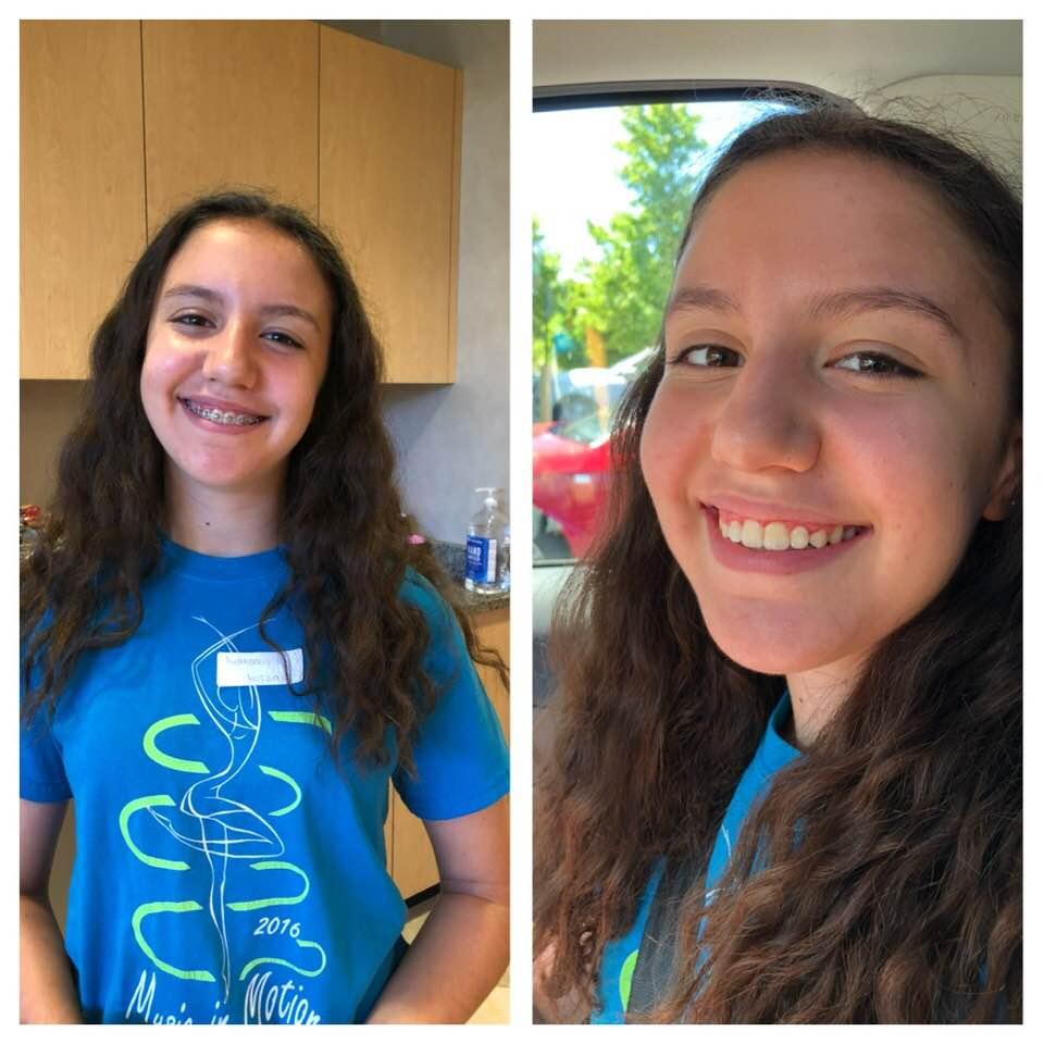 End of 8th grade. End of braces 😁