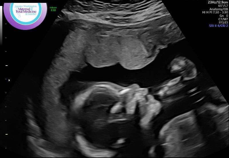 I just wanted to announce that my son and his girlfriend are going to have a little girl in August. No name has been chosen yet so I am keeping my fingers crossed that they don't give her any stripper names or bimbo names.