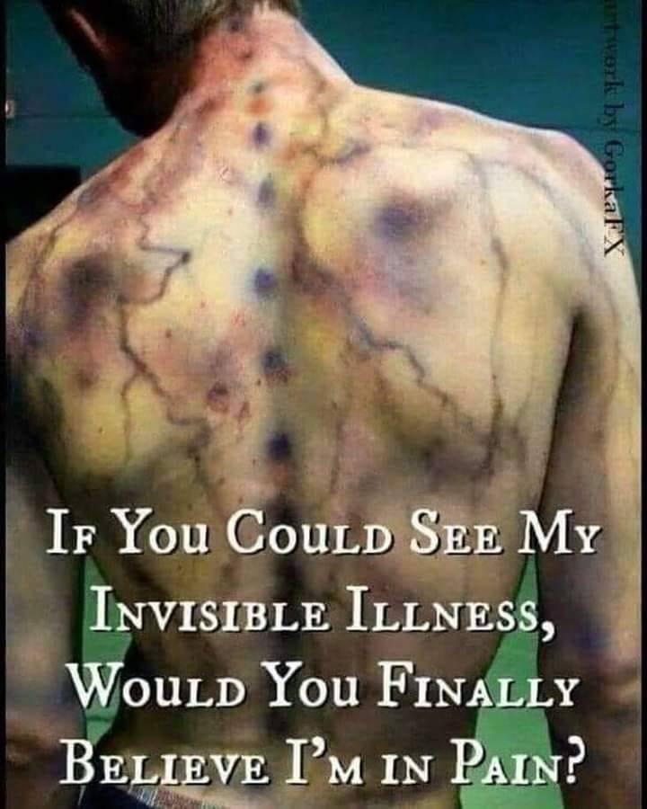 This is what my back feels like every day.
