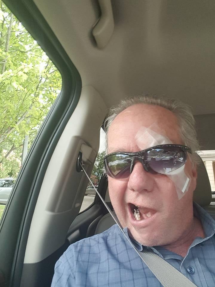 Channeling Dennis Hopper in Waterworld! Or its Talk like a Pirate II. Eye is not the trouble. Eyelid was.
