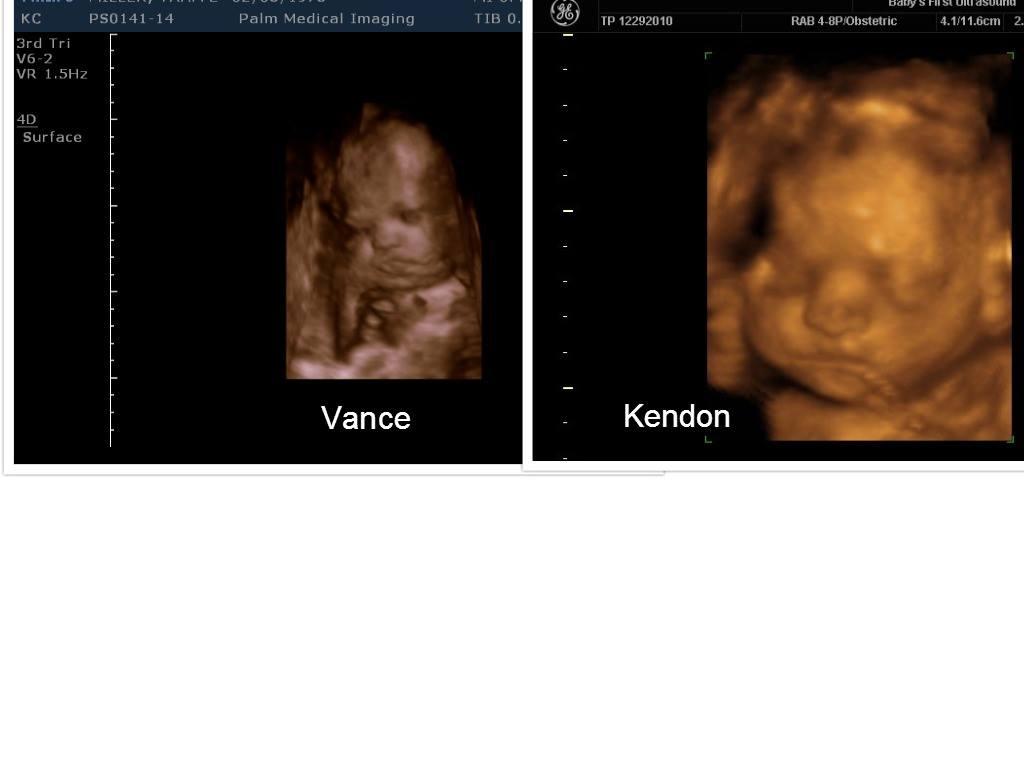 Yesterday was our big 3D/4D ultrasound and Vance would not turn around to get a full headshot, he insisted on resting half of his face in the placenta. I think my boys look pretty alike, but we'll be seeing here in anothe