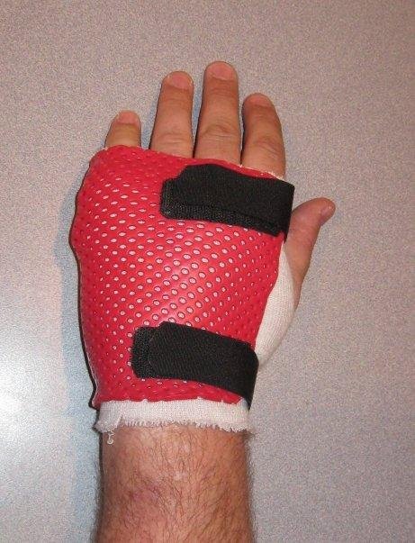 My hand protector - it's hard plastic formed around the pins sticking out of my hand.