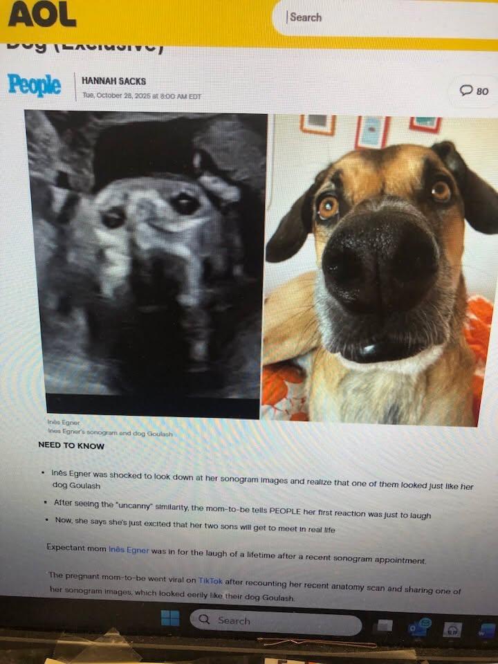 I had to share. This a woman’s sonogram. Her baby looks like her pet. Love it.