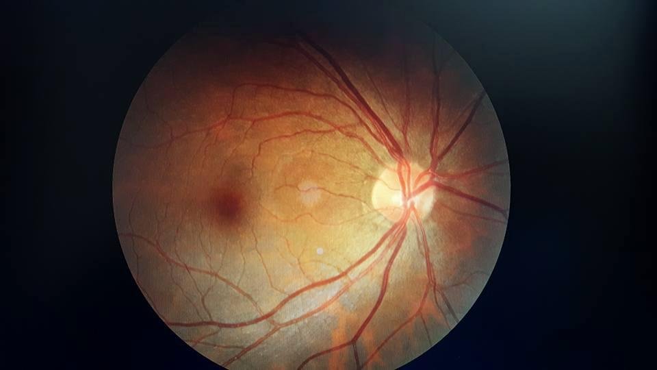 I got my Eye on you...Literally! took this pic from my eye exam